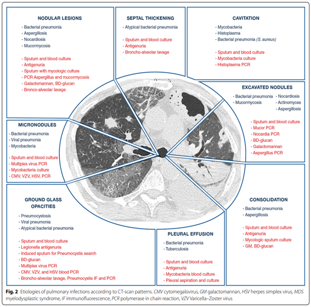 Afbeelding 2 CT afwijkingen