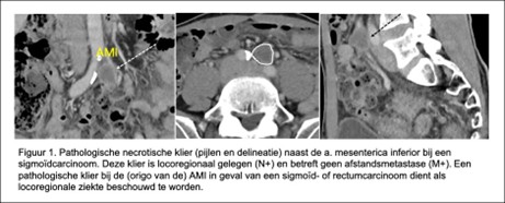 Figuur 1 Pathologische necrotische klier