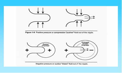 Figuur 1. Negative pressure or suction "draws" fluid out of the nipple
